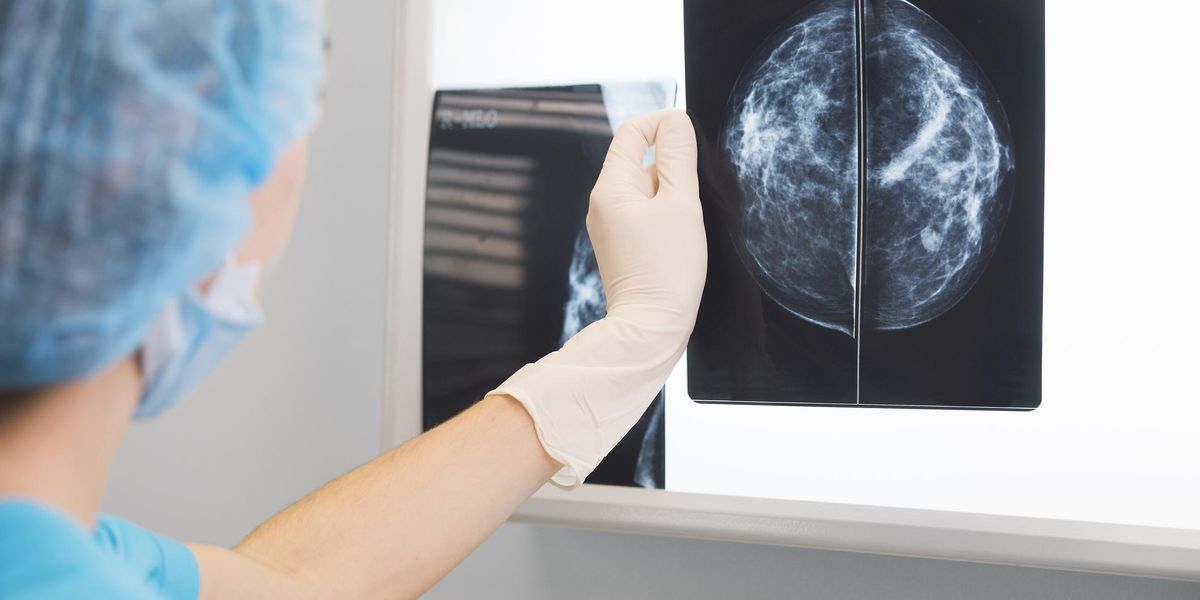 Covid 19 Vaccines And False Positive Mammograms When Should You Get