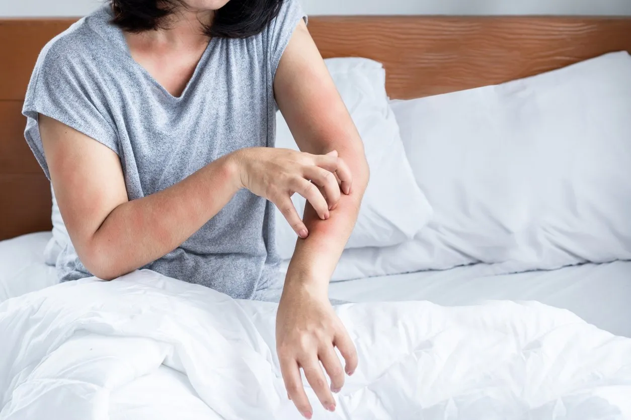 woman scratching her itchy skin due to liver disease