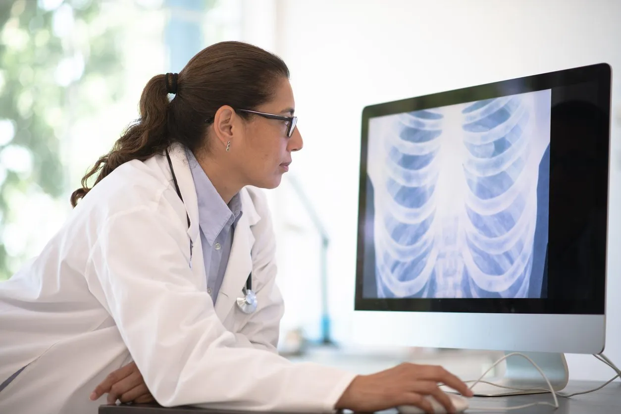 doctor of latino ethnicity leans on her desk and looks at a radiogram of a chest on her desktop computer.