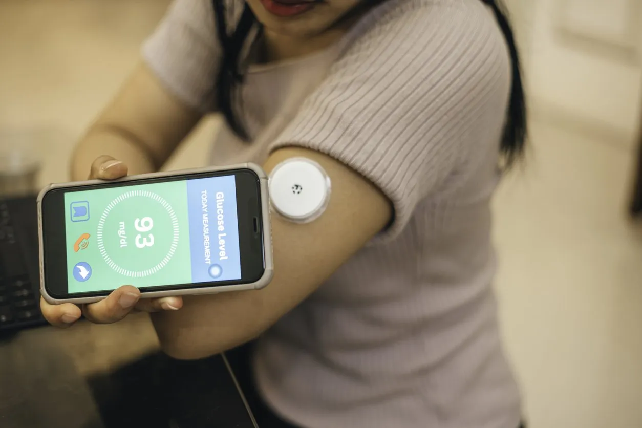 girl is wearing small sensor on the back of upper arm for measuring glucose levels due to diabetes.