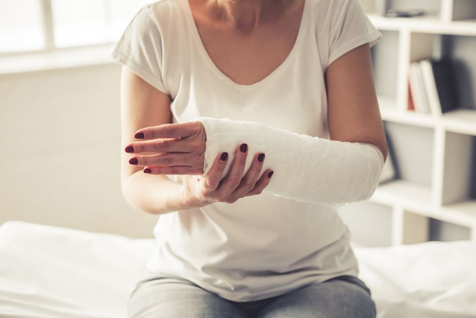 mature woman with her arm in a cast due to osetoporosis