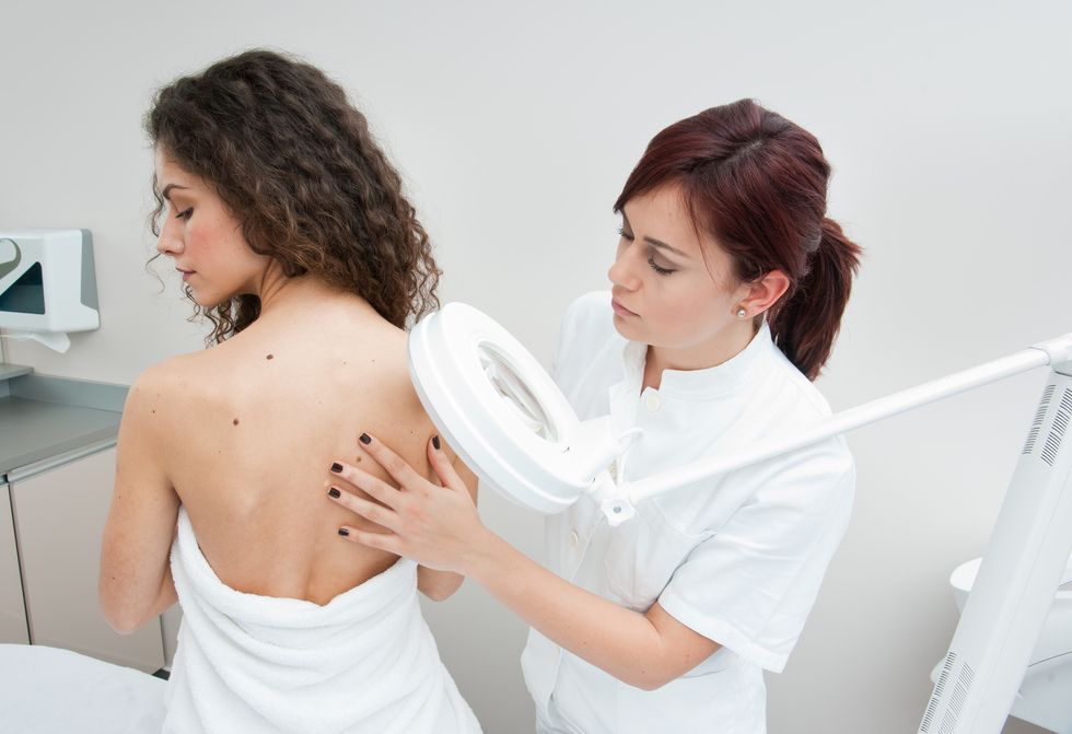 new-therapy-may-help-when-melanoma-spreads-to-brain-healthywomen