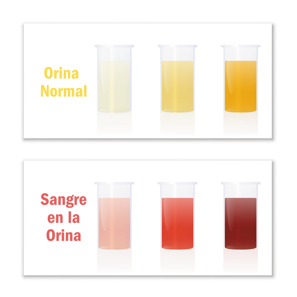 normal blood and urine in blood